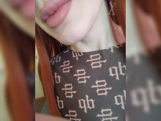 MEDOVAYA1 live cam